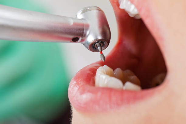 Best Weekend Emergency Dentist in Johnsonville, SC